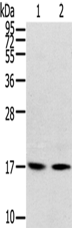 Rabbit Polyclonal Antibody to RPLP1
