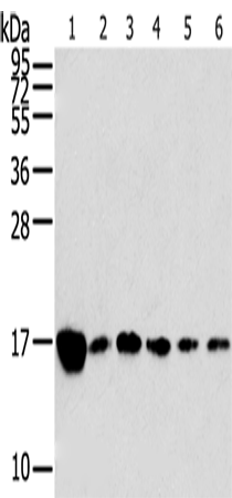 Rabbit Polyclonal Antibody to RPLP2