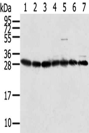 Rabbit Polyclonal Antibody to RPS3