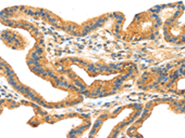 Rabbit Polyclonal Antibody to RRAGA