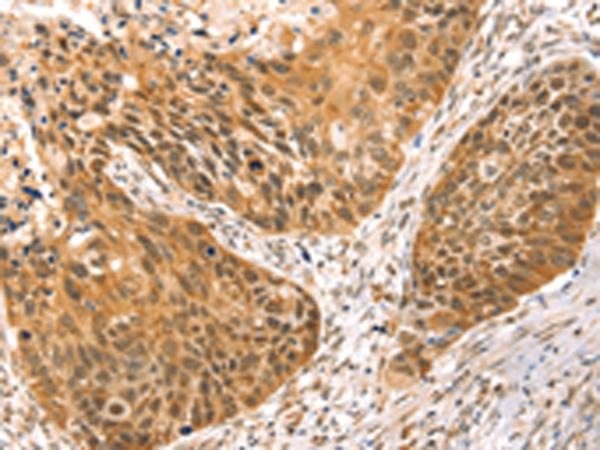 Rabbit Polyclonal Antibody to RRAGC