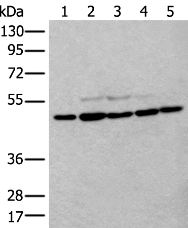 Rabbit Polyclonal Antibody to TUBB