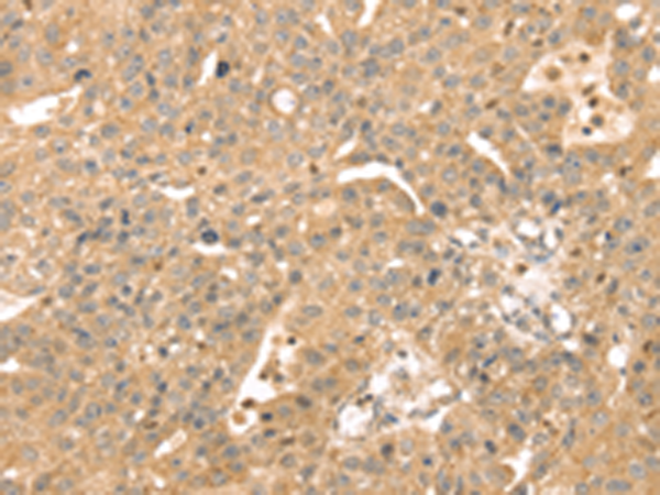 Rabbit Polyclonal Antibody to ATOX1