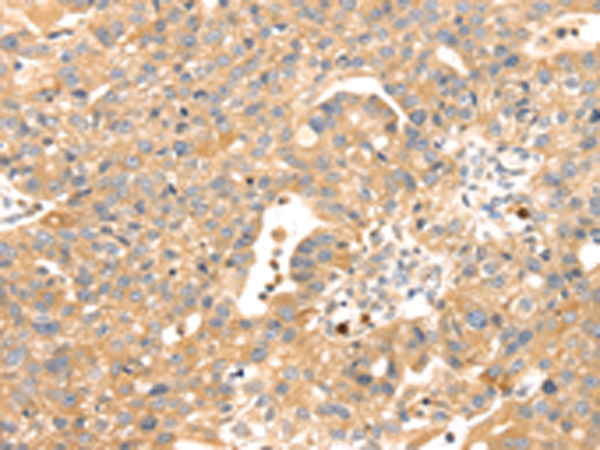 Rabbit Polyclonal Antibody to S100A12