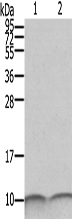 Rabbit Polyclonal Antibody to S100A6