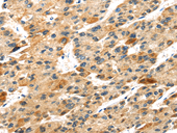Rabbit Polyclonal Antibody to S100A14