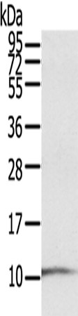 Rabbit Polyclonal Antibody to S100P