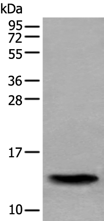 Rabbit Polyclonal Antibody to SAA4