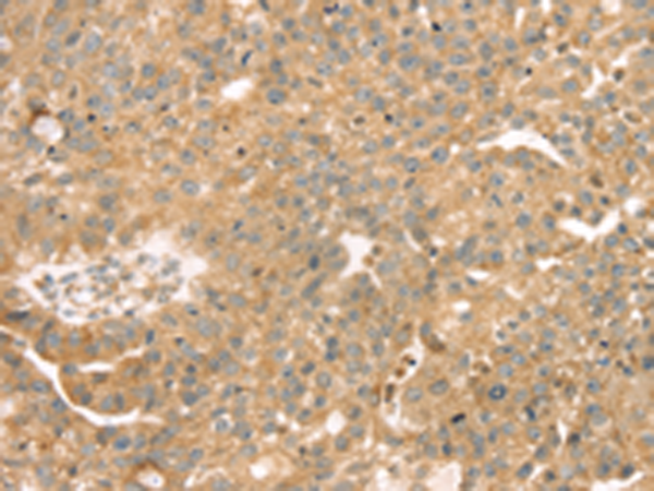 Rabbit Polyclonal Antibody to SAMD3
