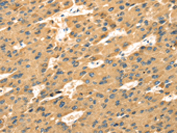 Rabbit Polyclonal Antibody to SAMD7