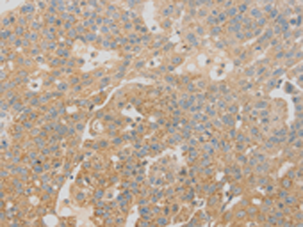 Rabbit Polyclonal Antibody to SCAP