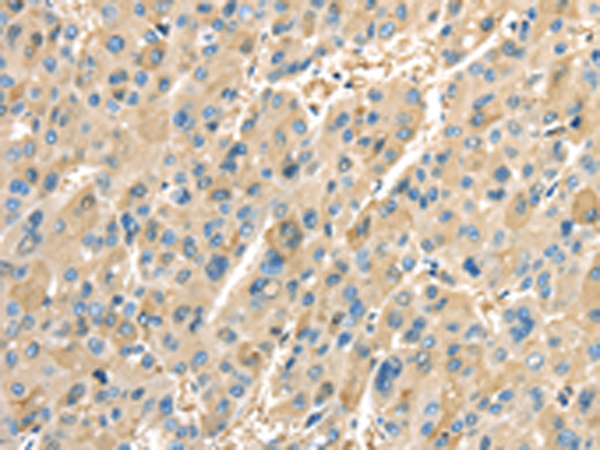 Rabbit Polyclonal Antibody to PTGS2