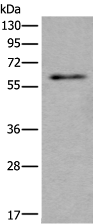 Rabbit Polyclonal Antibody to SCP2
