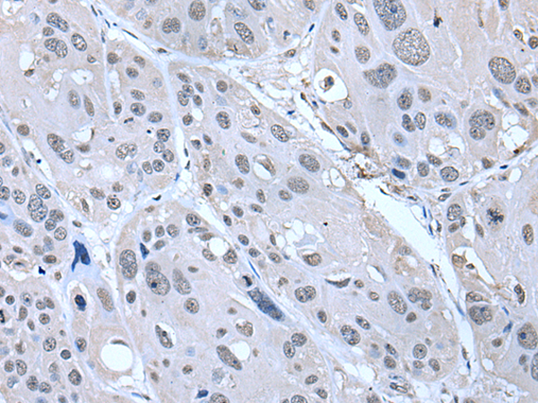 Rabbit Polyclonal Antibody to SERTAD1