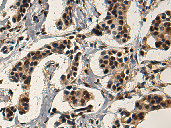 Rabbit Polyclonal Antibody to SERTAD3