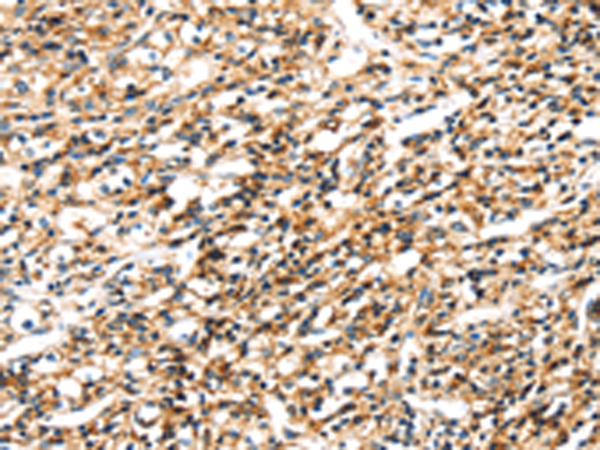 Rabbit Polyclonal Antibody to SEMA4A