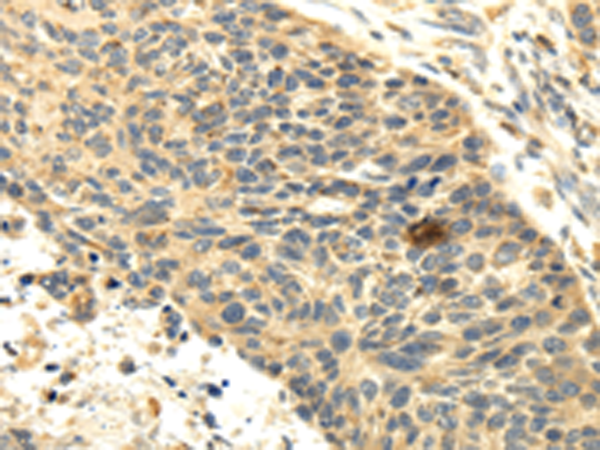 Rabbit Polyclonal Antibody to SEMA4F