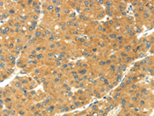 Rabbit Polyclonal Antibody to SEMA4C