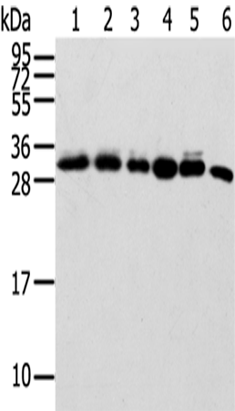Rabbit Polyclonal Antibody to SENP8