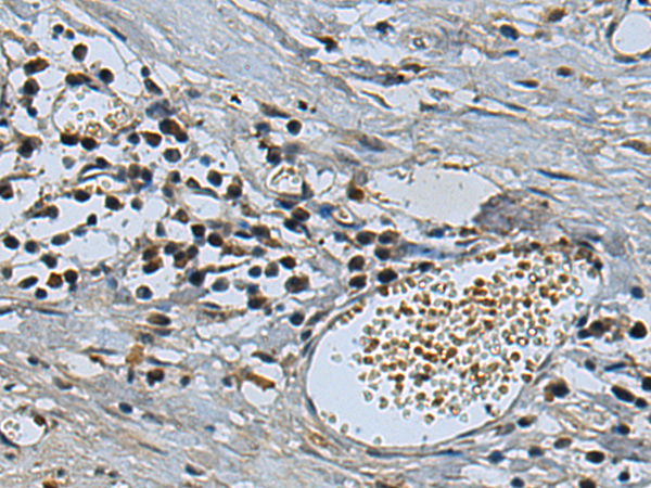 Rabbit Polyclonal Antibody to SENP5