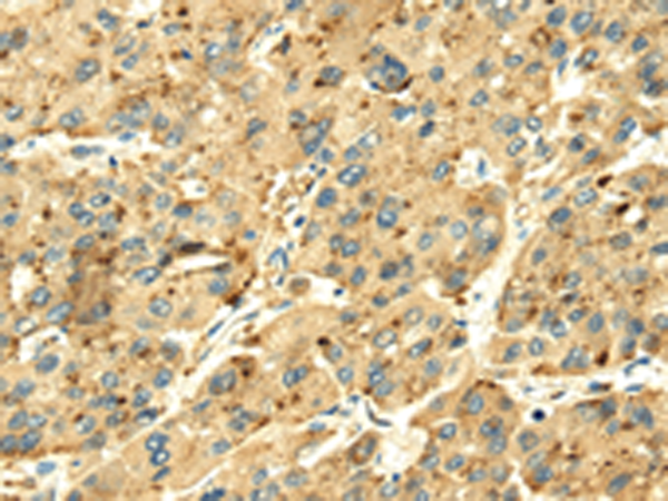 Rabbit Polyclonal Antibody to SENP2