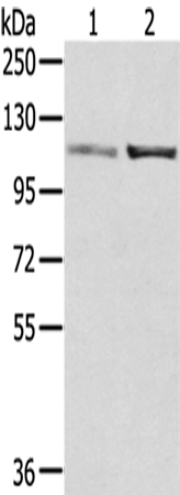 Rabbit Polyclonal Antibody to SENP7