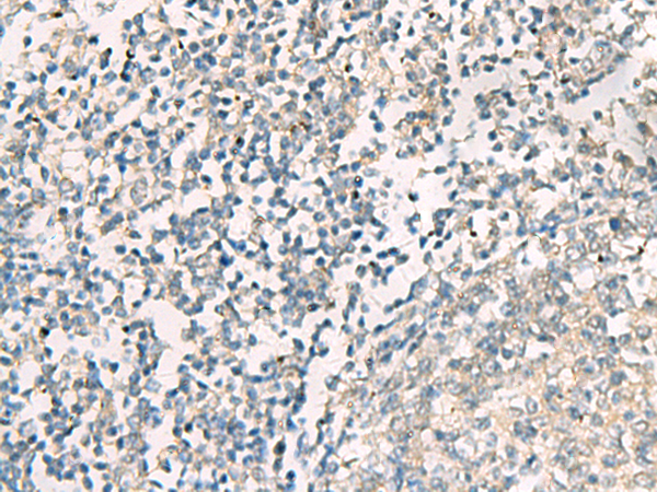 Rabbit Polyclonal Antibody to SERPINB4