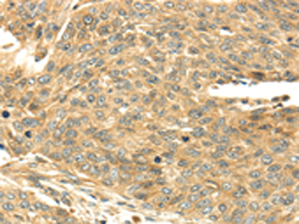 Rabbit Polyclonal Antibody to SERPINA12