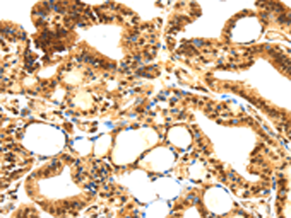 Rabbit Polyclonal Antibody to SERPINB1