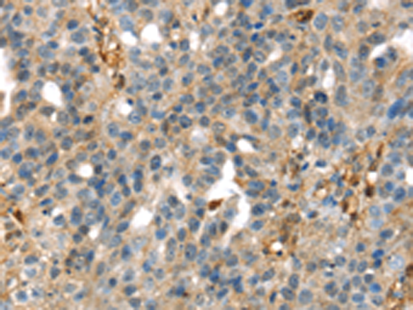 Rabbit Polyclonal Antibody to SERPINB6
