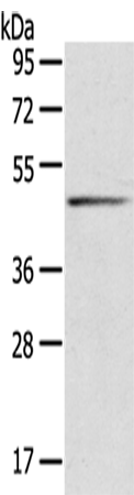 Rabbit Polyclonal Antibody to SERPINB8