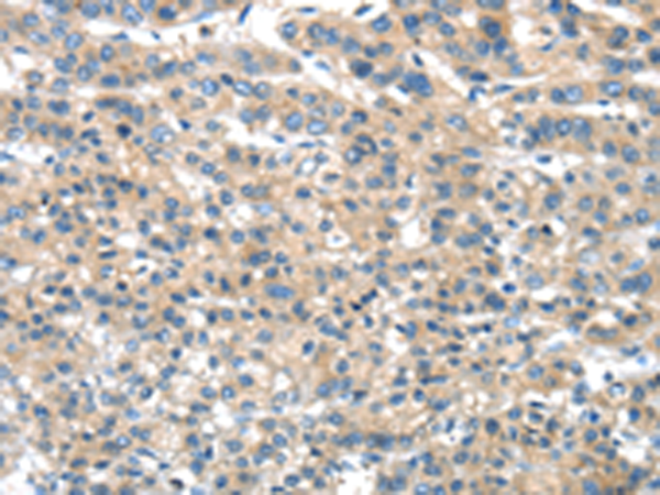 Rabbit Polyclonal Antibody to DNAJA3