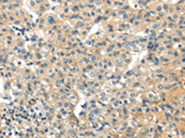 Rabbit Polyclonal Antibody to SESN3