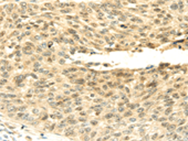 Rabbit Polyclonal Antibody to SHPRH