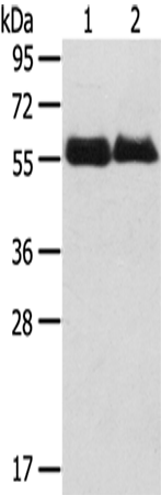 Rabbit Polyclonal Antibody to SRPX