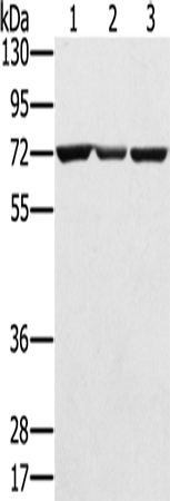 Rabbit Polyclonal Antibody to SLC25A13