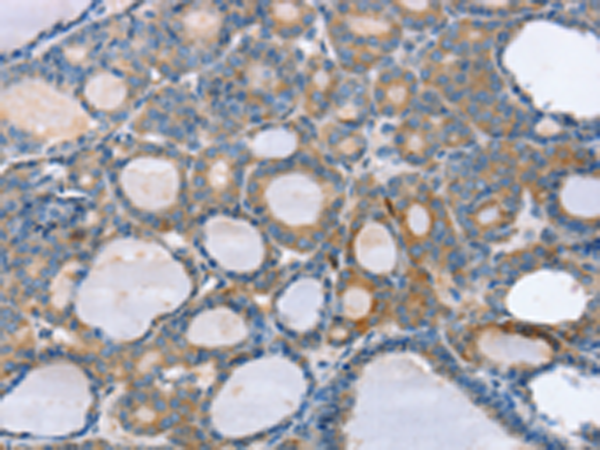 Rabbit Polyclonal Antibody to SLC25A1
