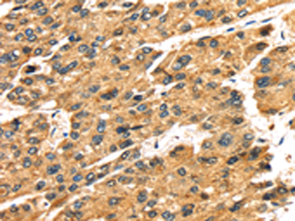 Rabbit Polyclonal Antibody to SLC25A26