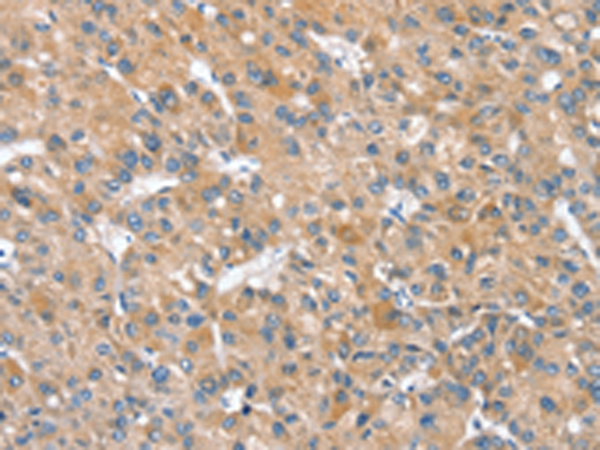 Rabbit Polyclonal Antibody to SLC25A2