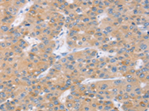 Rabbit Polyclonal Antibody to SLC27A2