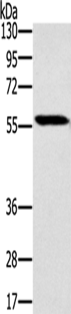 Rabbit Polyclonal Antibody to SLC29A4