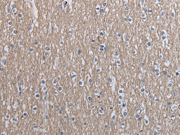Rabbit Polyclonal Antibody to SLC39A14