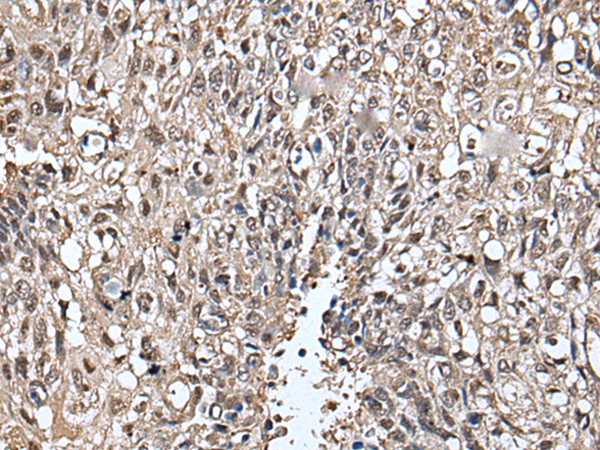 Rabbit Polyclonal Antibody to SLITRK5