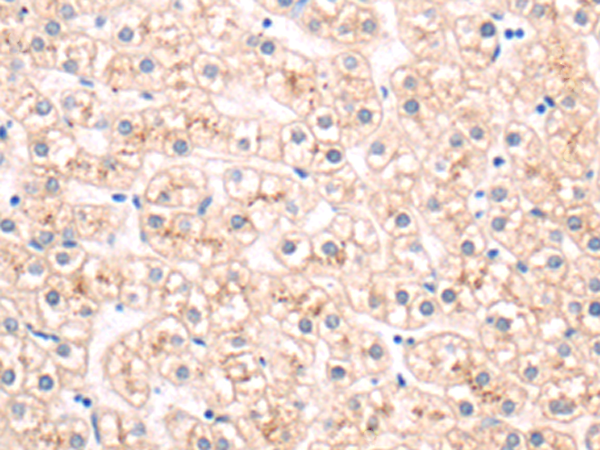 Rabbit Polyclonal Antibody to SLITRK6