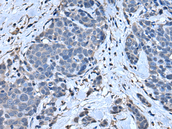 Rabbit Polyclonal Antibody to SLPI