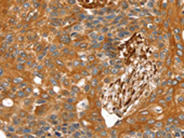 Rabbit Polyclonal Antibody to TAGLN