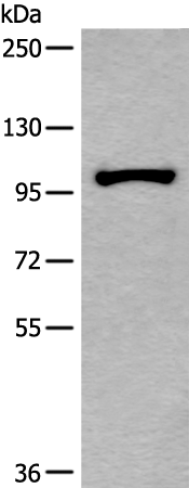 Rabbit Polyclonal Antibody to HELLS