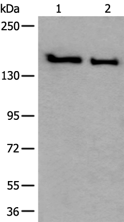 Rabbit Polyclonal Antibody to SMC1A