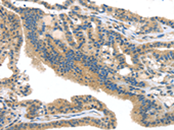 Rabbit Polyclonal Antibody to SMYD3