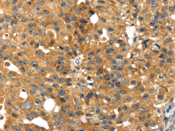 Rabbit Polyclonal Antibody to SMYD4